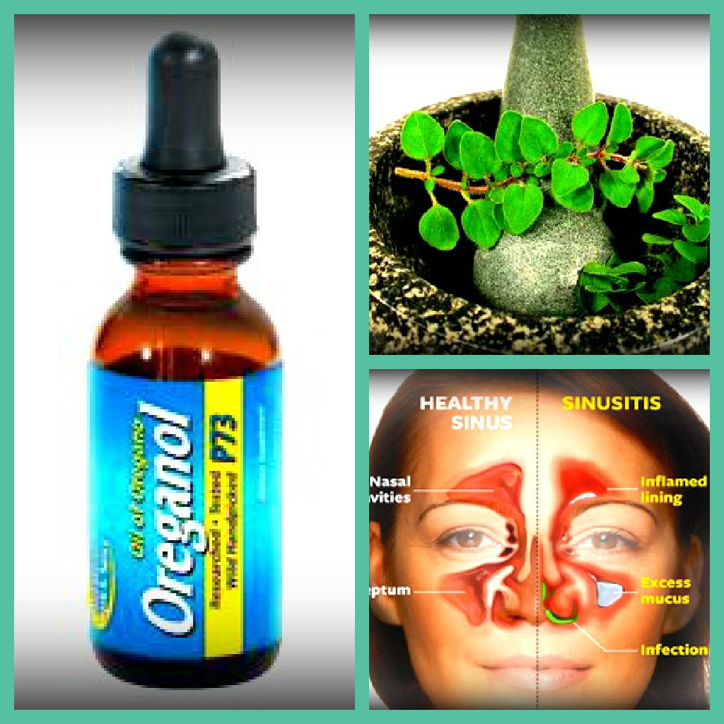 Can you use oil of oregano to treat sinus problems?